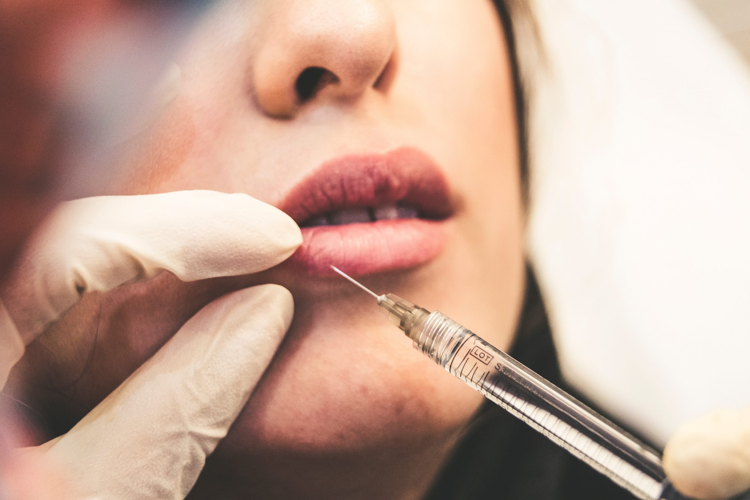 closeup of procedure, dermal filler, needle at woman's lip