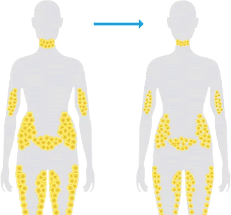 Fat cells after typical weight loss