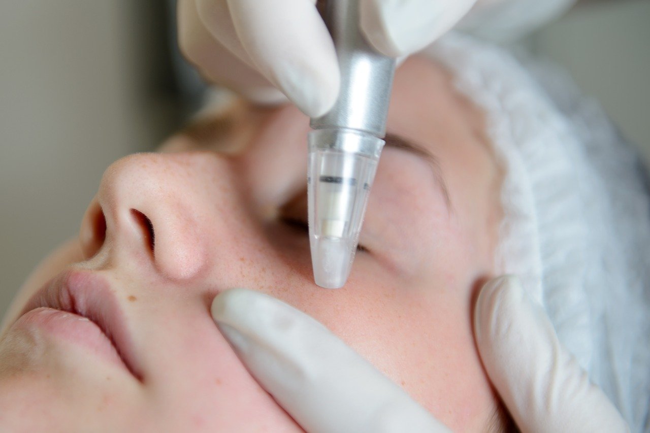 closeup of person receiving microdermabrasion treament