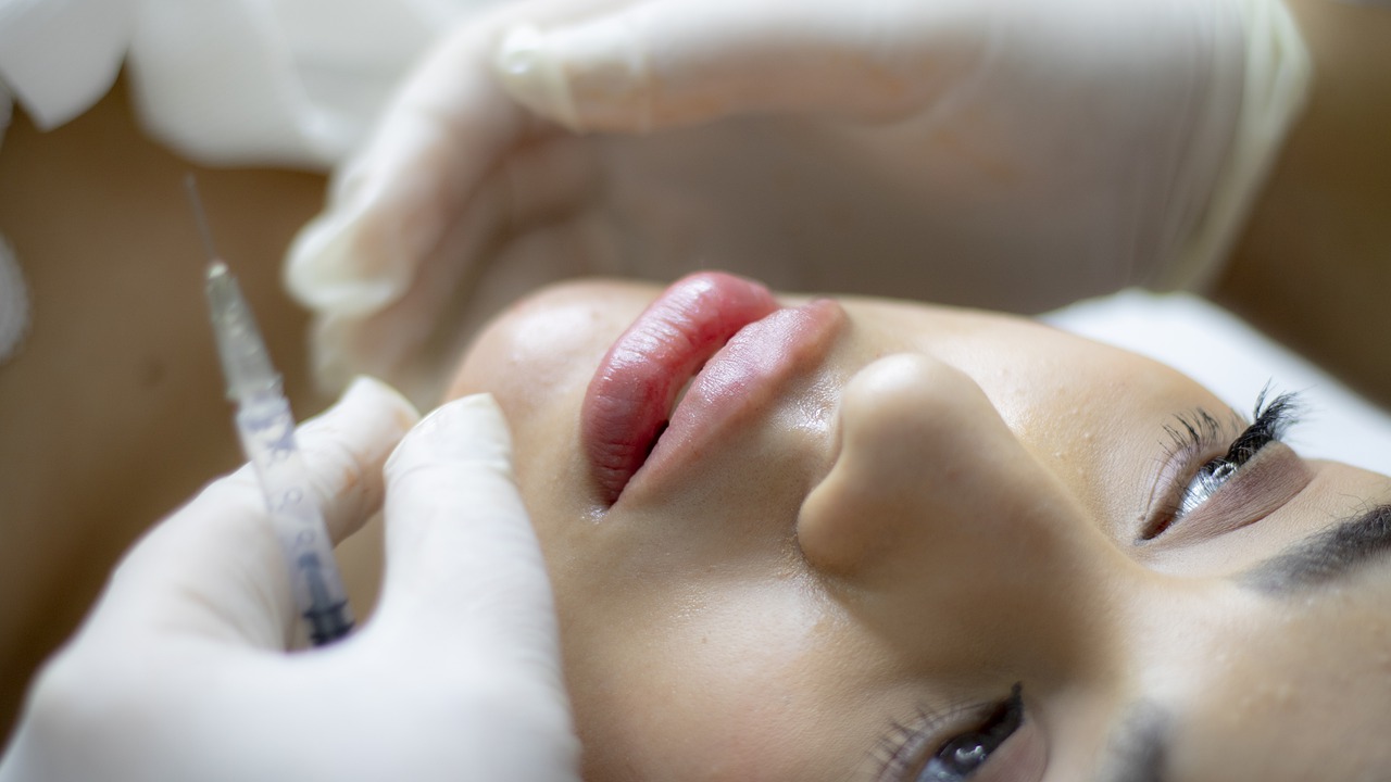 closeup of person receiving lip fillers, lip augmentation process