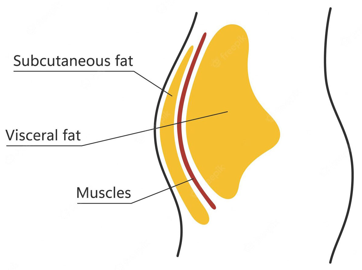 Visceral subcutaneous fat around waistline
